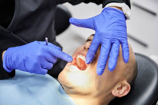 Best Walk-In Emergency Dentist in Lubeck, WV