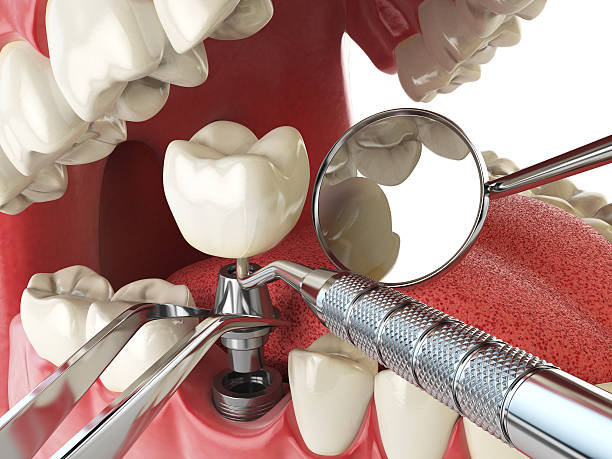 Best Emergency Tooth Extraction in Lubeck, WV